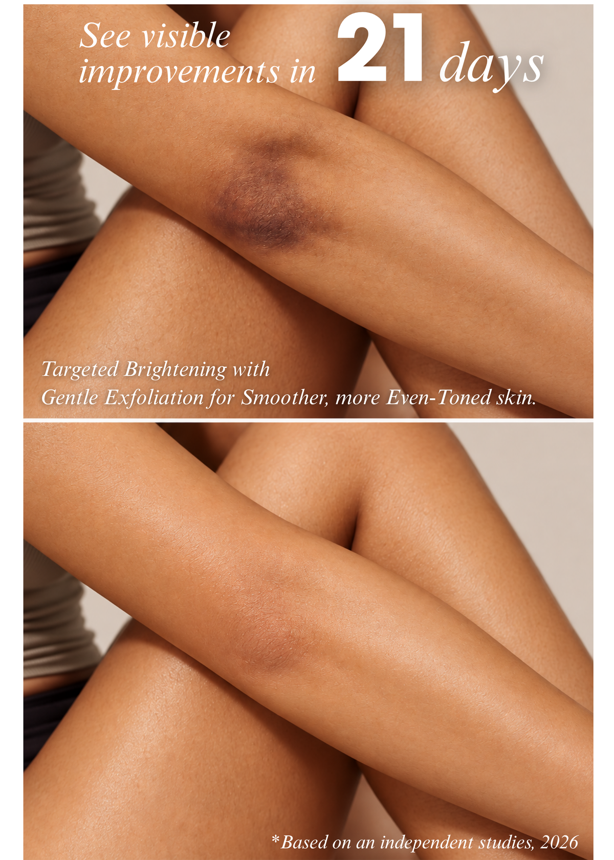 Fade Anti-Pigmentation Bar