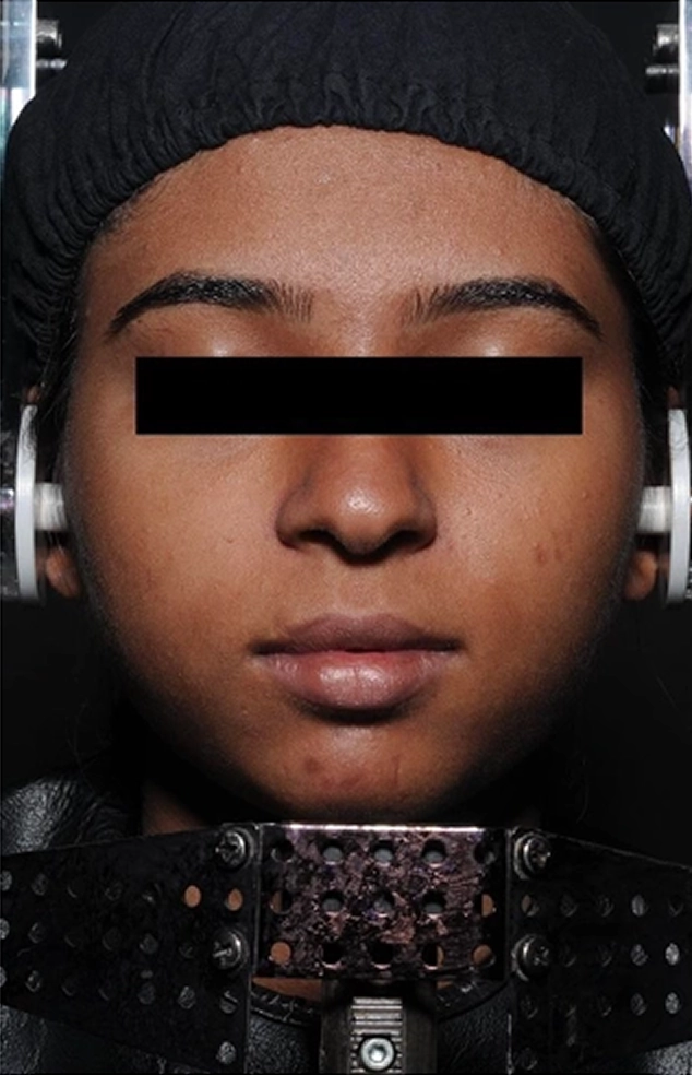 Clinical trial participant 1 after 28 days