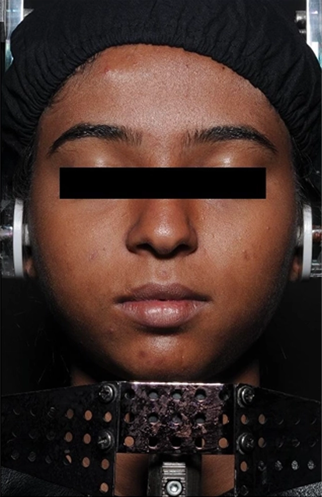 Clinical trial participant 1 at day 0